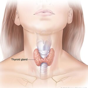 Double chin caused by thyroid