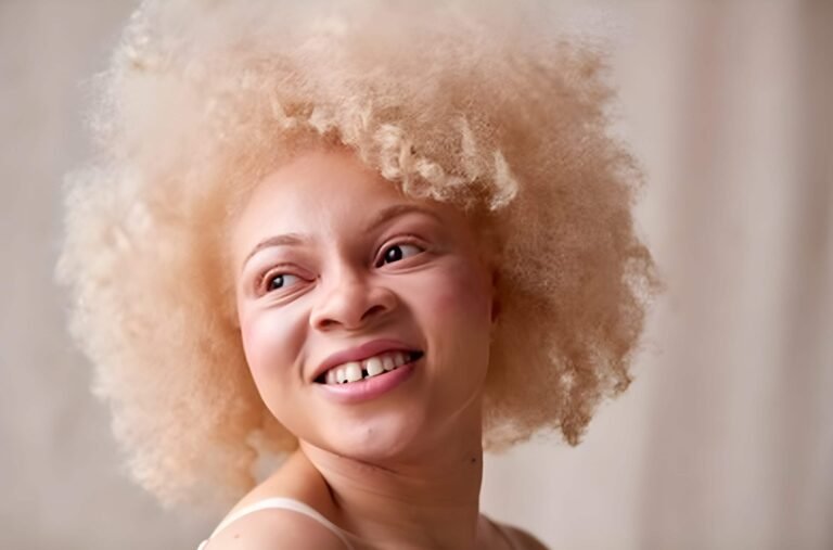 Can Albino People Dye Their Hair?